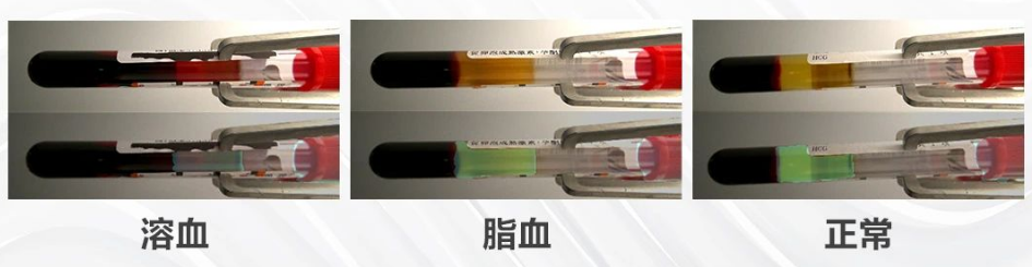 血液質(zhì)量檢測.png 血液質(zhì)量檢測.png
